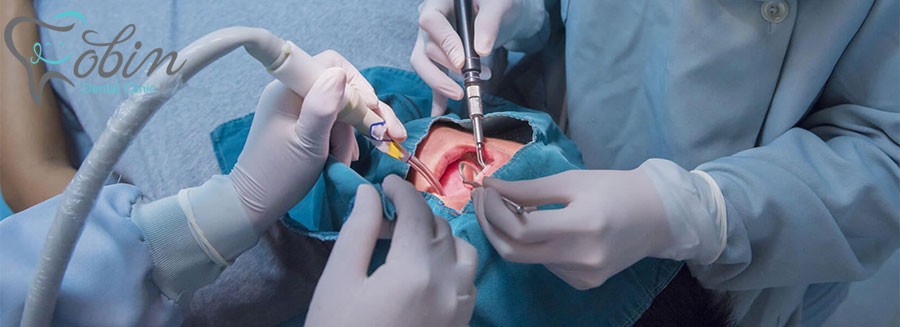 بررسی همه چیز درباره ی جراحی دندان